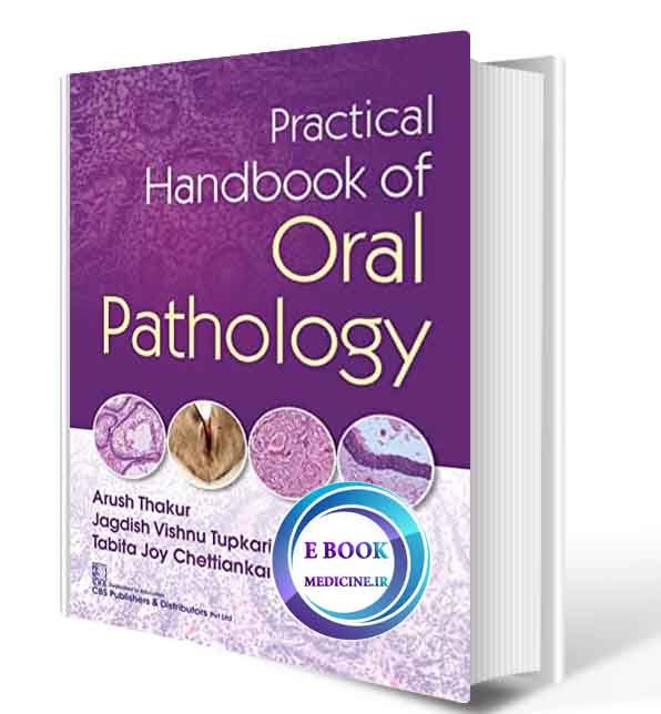 دانلود کتاب  Practical Handbook of Oral Pathology 2020(ORIGINAL PDF)